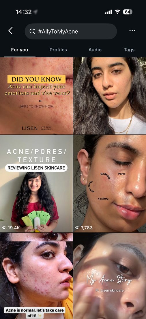 Ally to My Acne 1