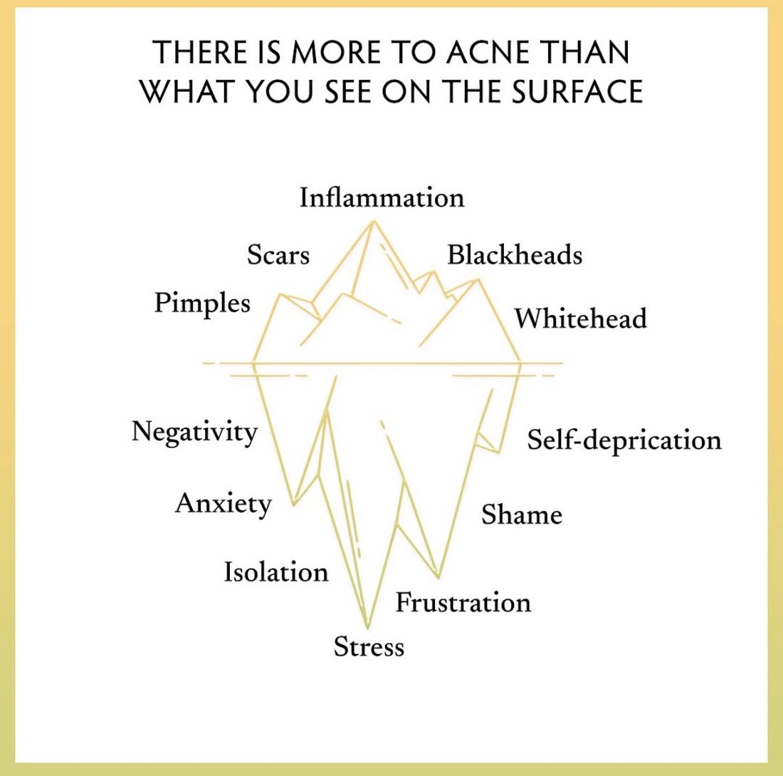 Ally to My Acne 3